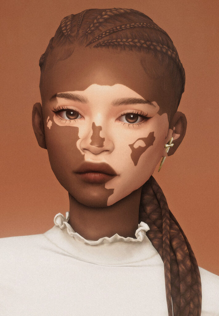 Un sim con una camiseta blanca y vitiligo en su rostro. Su cabello está en una trenza lateral.